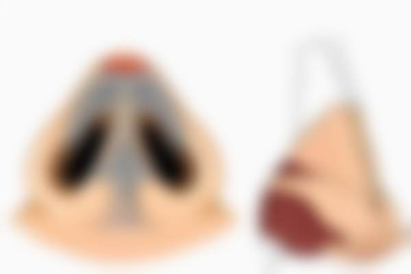 【艾莉薇传奇版玻尿酸1mL特别优惠促销】顾客实例见证