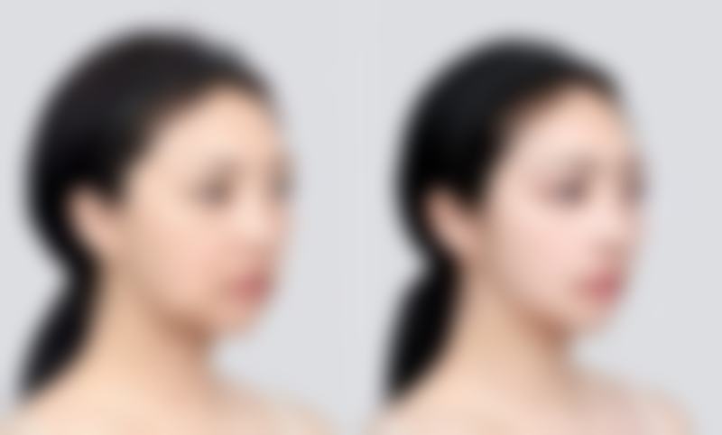 福州亚美医疗美容诊所更擅长什么手术