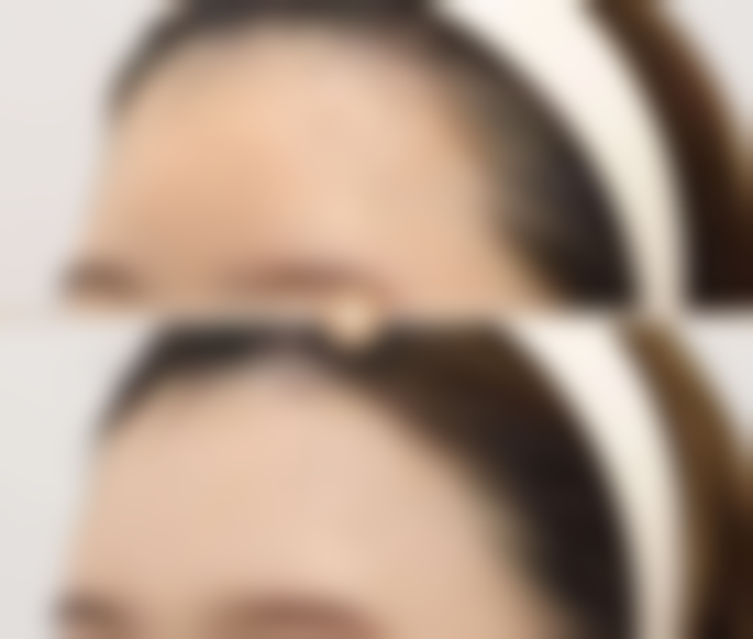 李继青医生口碑如何