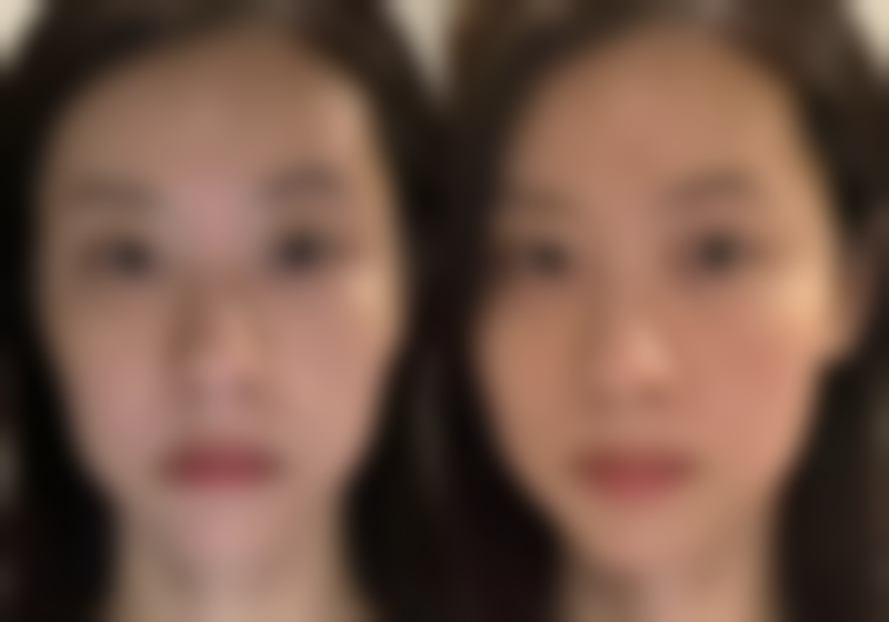 乐通城医生简介之项目优势