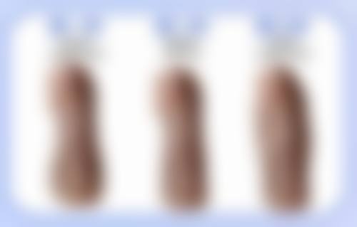 怎么样才能有效消除熬夜眼袋之内调外养与作息调整