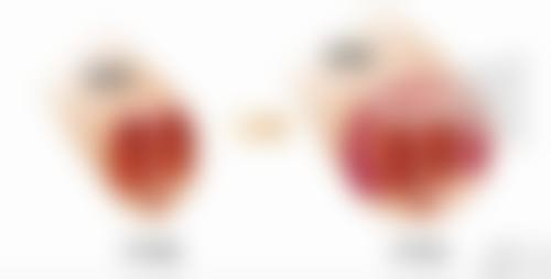 王文医生简介做手术价格