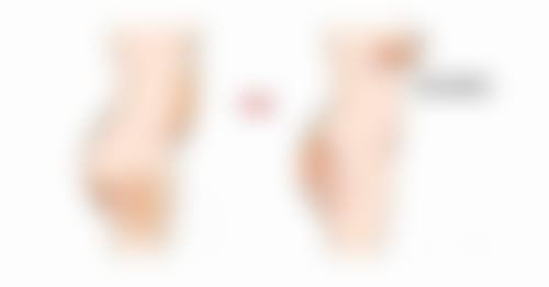 为什么疤痕愈合后会痒:止痒全攻略,告别瘙痒困扰