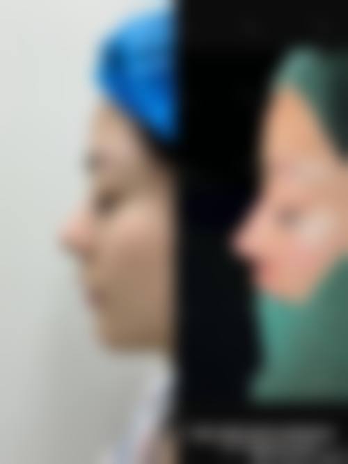 江苏南京康美医疗整形美容医院口碑好不好？附真实患者口碑评价