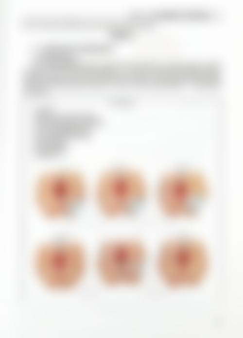 濮阳市油田总医院烧伤整形科口碑好不好？附真实患者口碑评价