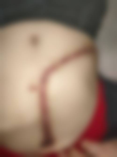 济宁安美聚光医疗美容诊所怎么样，怎么挂号，地址在哪儿