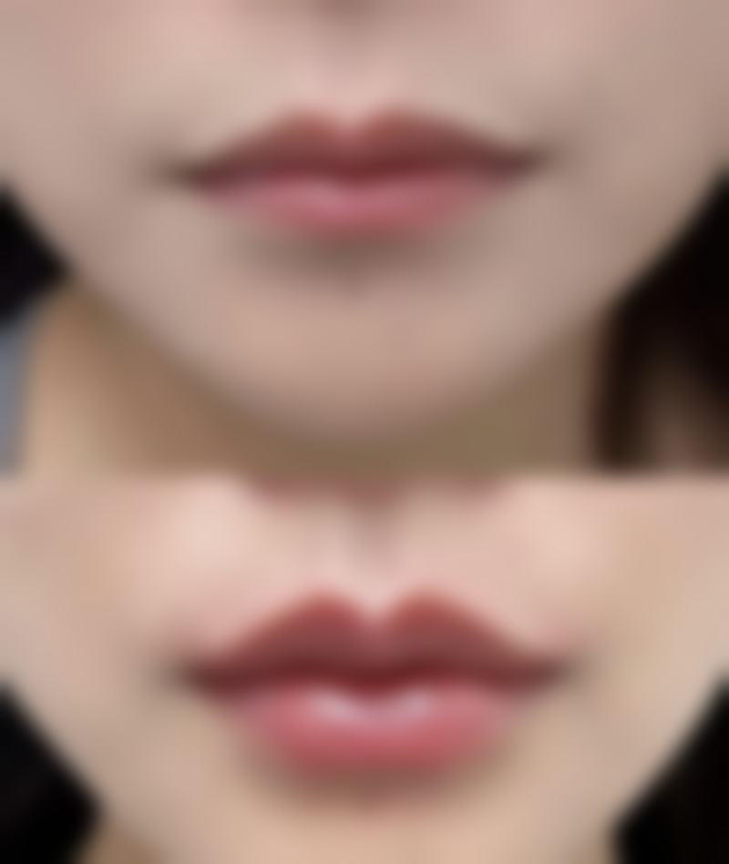 昆明悦玲珑医疗美容医院价格表