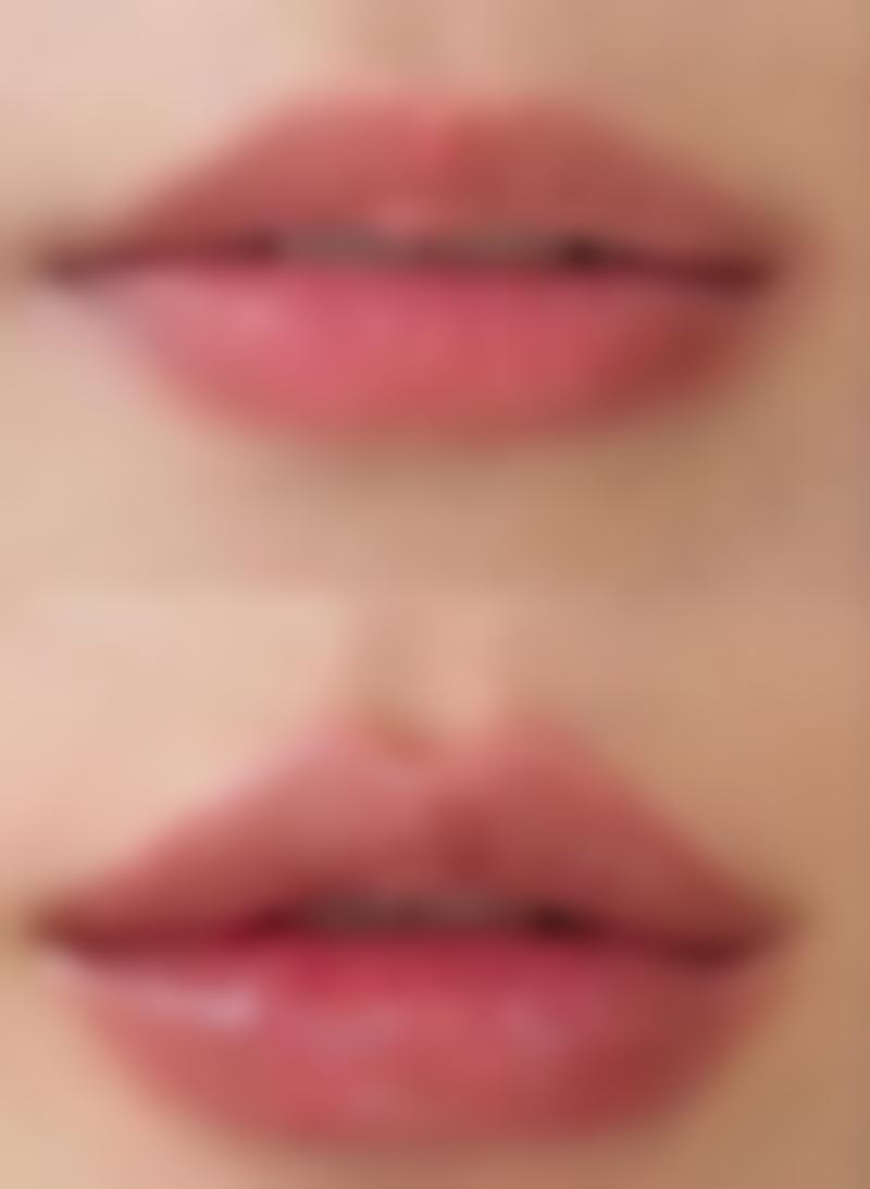 钟鸿文医生做手术价格