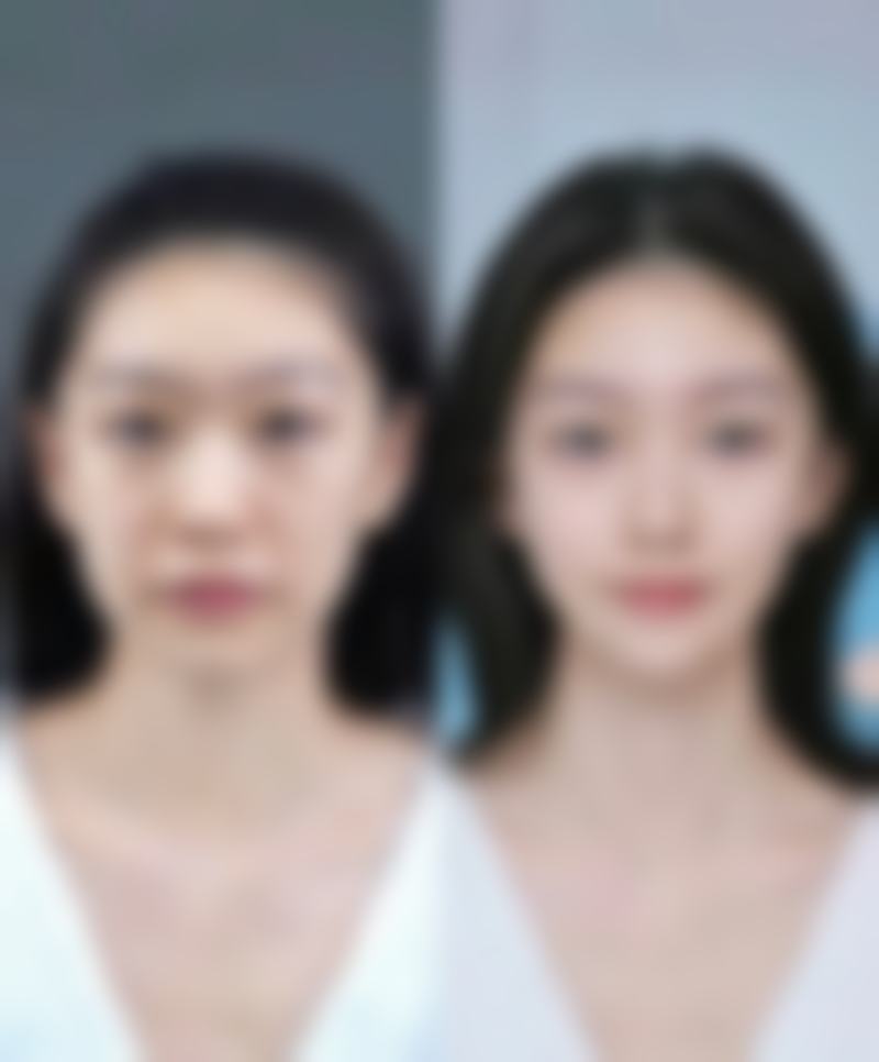 上海德琳医疗美容医院(男性私密中 心)相俊常见问题Q&A