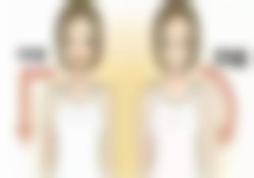 全切双眼皮切眼袋多久消肿:不同医院类型的消肿差异分析