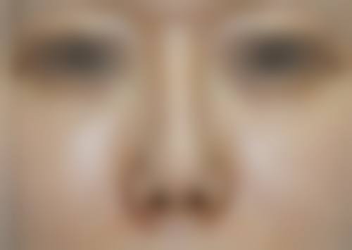 舒慧恺医生做手术价格