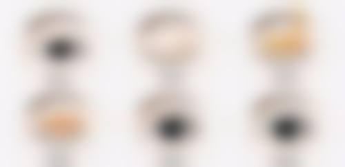 眼袋手术两侧不对称修复几率大吗