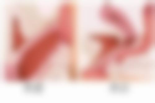 全切双眼皮切眼袋多久消肿:专精整形医院的选择技巧