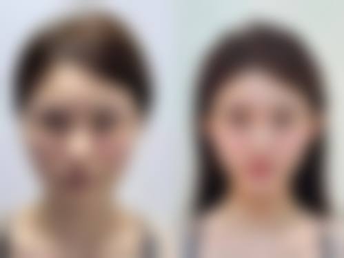 武汉斯启诺医疗美容门诊部董雷收费价目表中的眼部整形优势