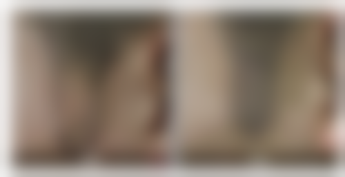 新生植发连锁怎么样，医生情况如何？