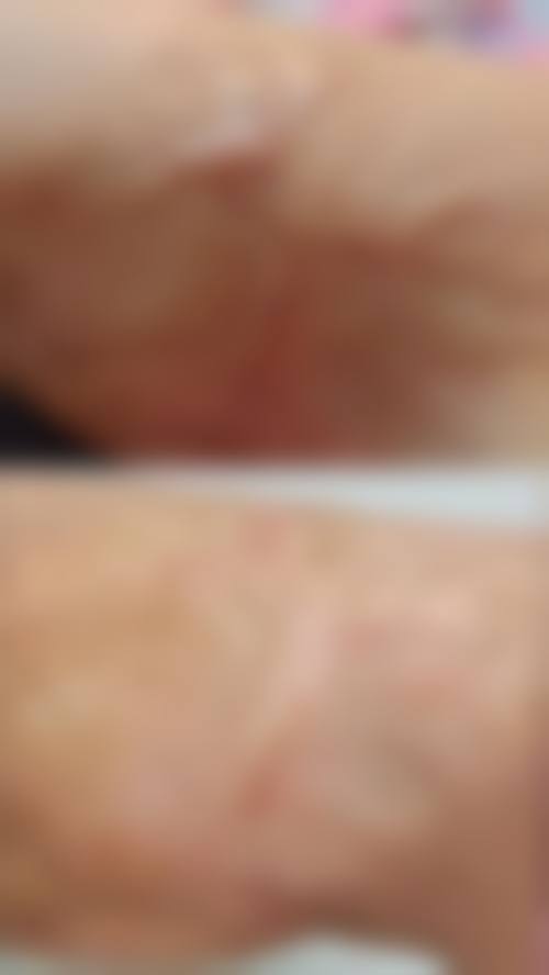 舒慧恺医生项目优势