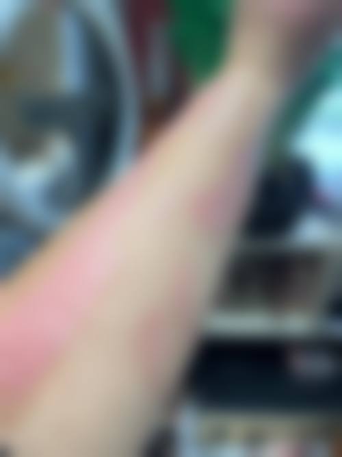 成都美丽部落荟美医疗美容门诊部怎么样