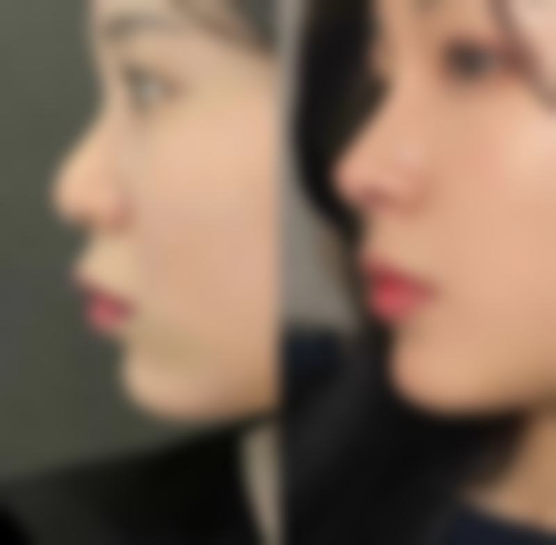 舒慧恺医生怎么挂号