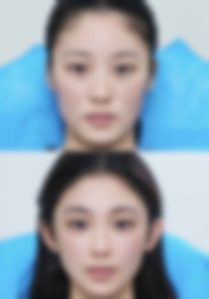 四、成都高新蓉创臻美整形医院怎么样——项目特色