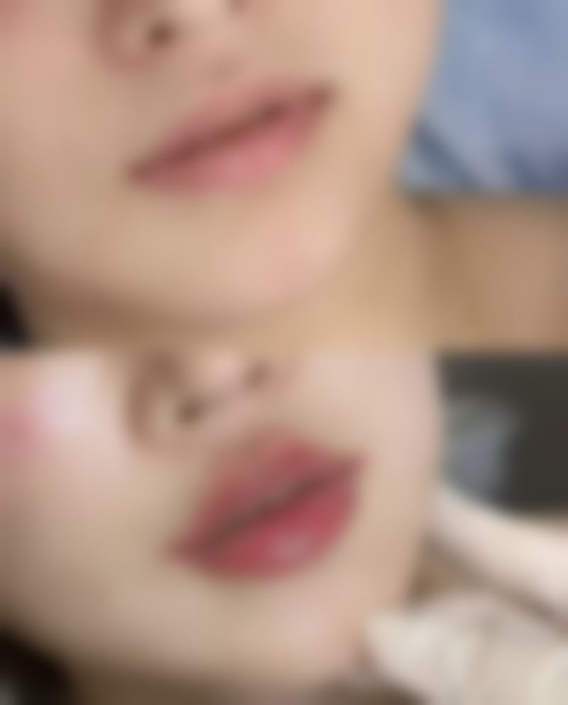 怎么按摩消除眼袋——按摩小贴士，助力成效升级