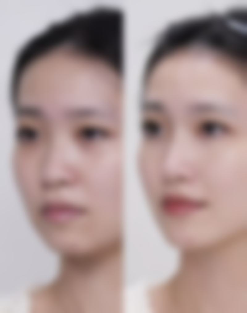 北京沁伊尔医疗美容诊所怎么样，更擅长什么