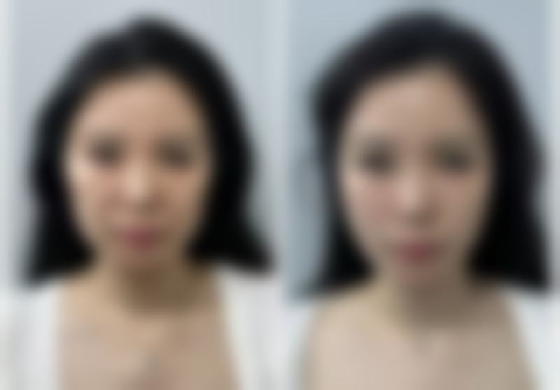 孙长生医生做手术价格