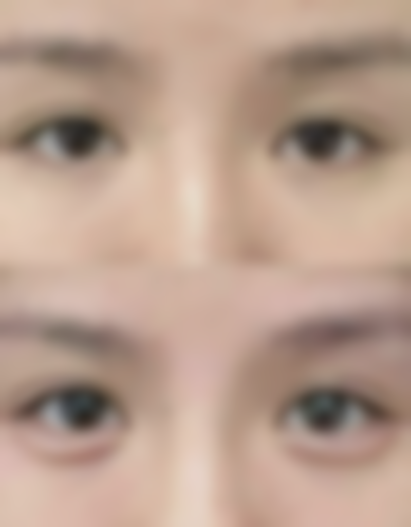 哈尔滨名一医疗美容门诊部顾客实例