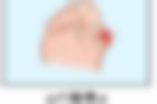 手臂吸脂淤青修复时间