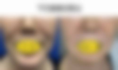 杭州华 山连天美医疗美容整形医院项目特色