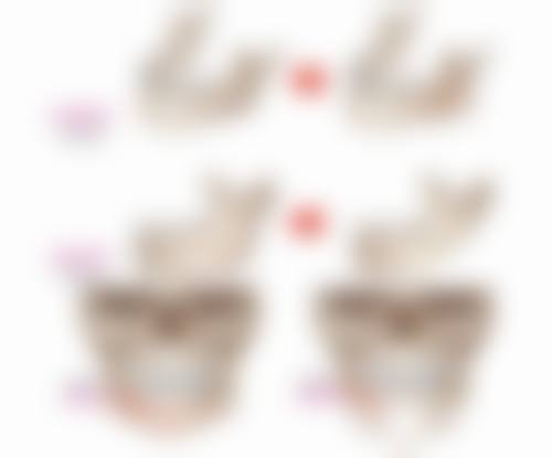 有医生院建议的眼袋手术后疤痕膏——肝素钠尿囊素凝胶