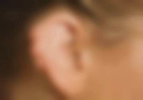 红色凹陷疤痕怎么消除：手术选择——末尾一道防线