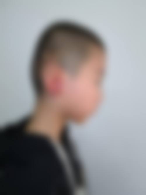 崔宁波医生顾客实例图片