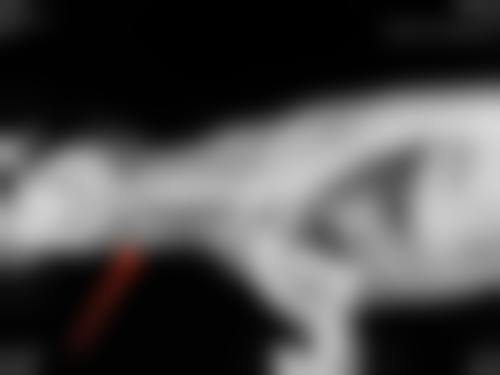 邵刚医生简介做手术价格