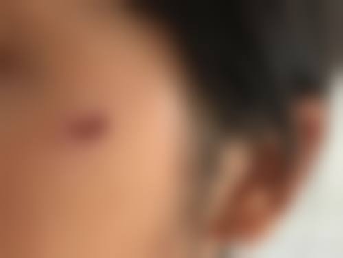 杭州华 山连天美医疗美容整形医院价格表