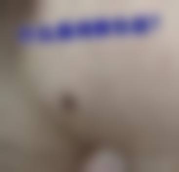 秀美颜整形医院项目特色