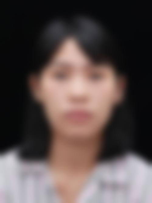 首都医 科 大学附属北京同仁医院眼整形科怎么样,口碑评价如何?