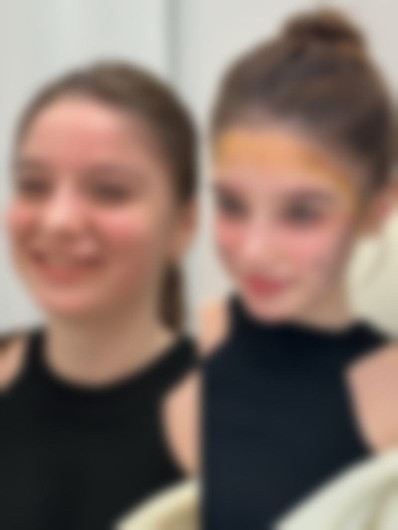 疤痕体质的疤痕自己会消除吗？手术烫伤疤痕能否淡化看体质