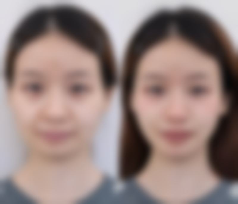 陈美燕医生顾客实例图片