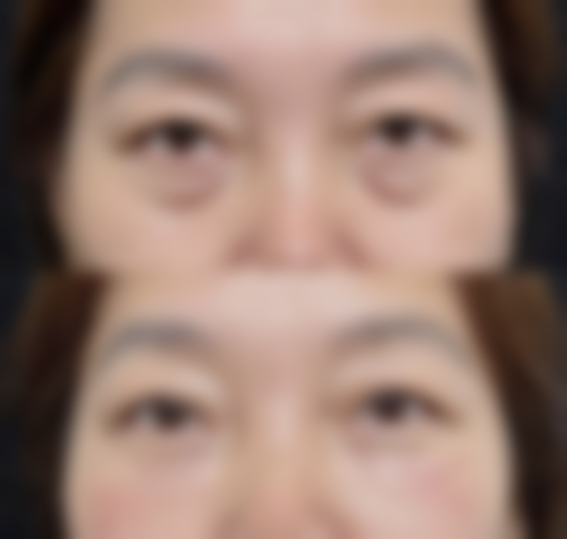 随涛医生做手术价格