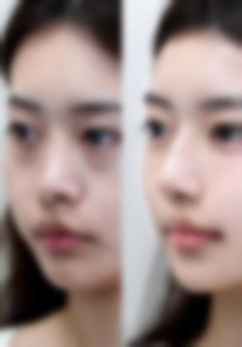 南通市第三人民医院烧伤整形美容科怎么样,口碑评价如何?