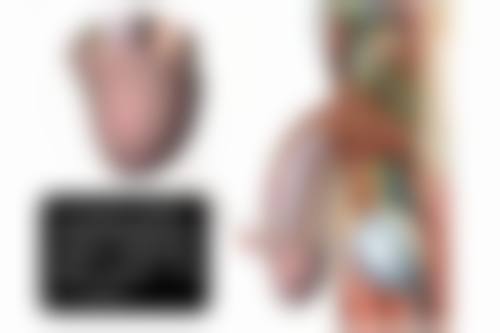 专精医生做大腿抽脂能瘦多少厘米？技术决定上限