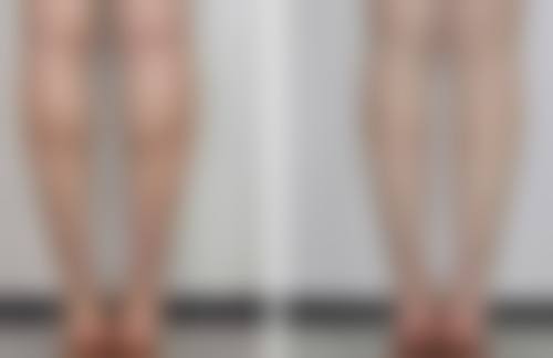 扬州俏华美医疗美容诊所高军飞2026坐诊情况——扬州施尔美医疗美容医院