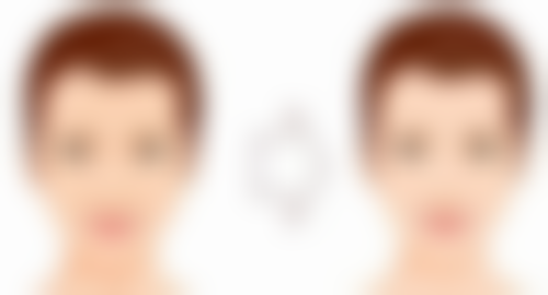 艾条去除眼袋的注意事项之安心保护