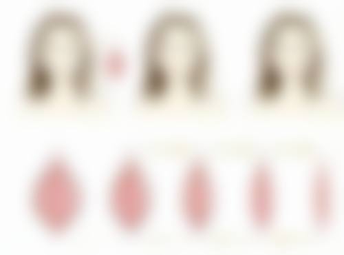 疤痕体质取痣后留疤问题与解决办法