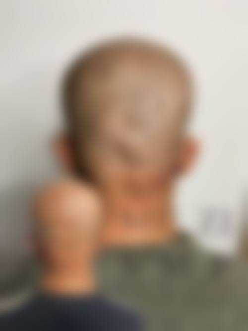 重庆万悦整形医院口碑好不好？附真实患者口碑评价