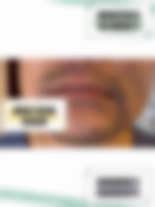 青岛洋美毛发种植研究所的口碑好不好