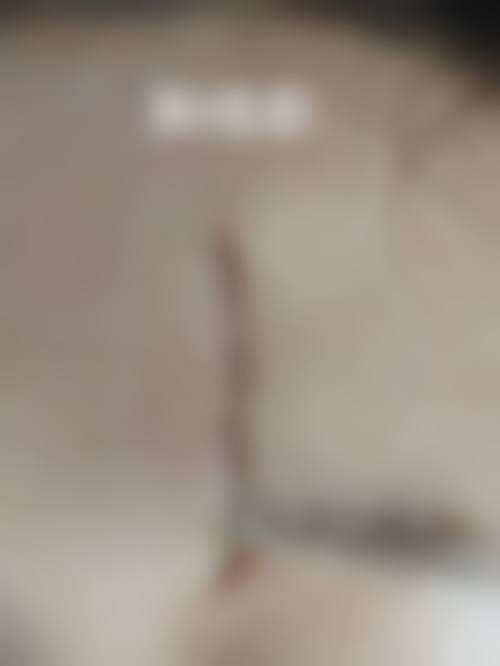 慈溪叶姿妤(艳后)医疗美容门诊部怎么样,更擅长什么