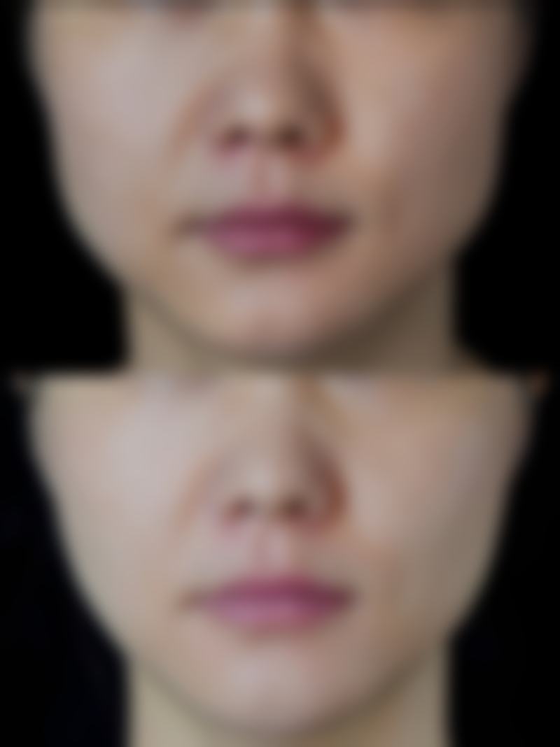 慈溪叶姿妤(艳后)医疗美容门诊部怎么样,基本情况如何