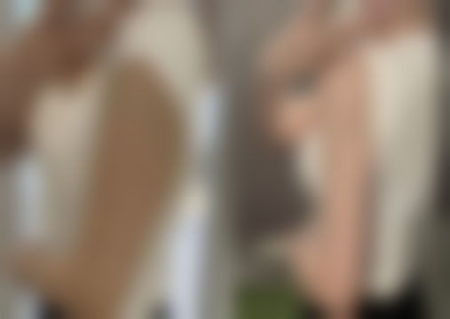 血压高能做眼袋手术吗:身体条件的严格考量