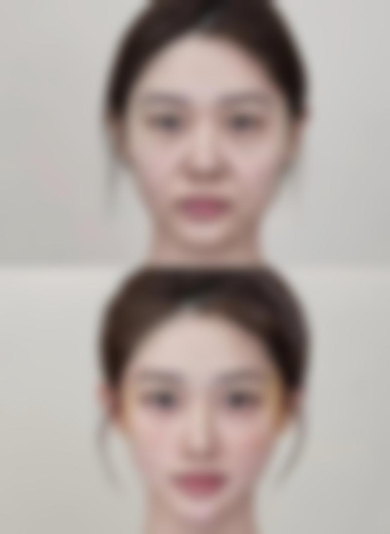 去完眼袋有皱纹怎么办之产品推荐：精选“皱纹克星”